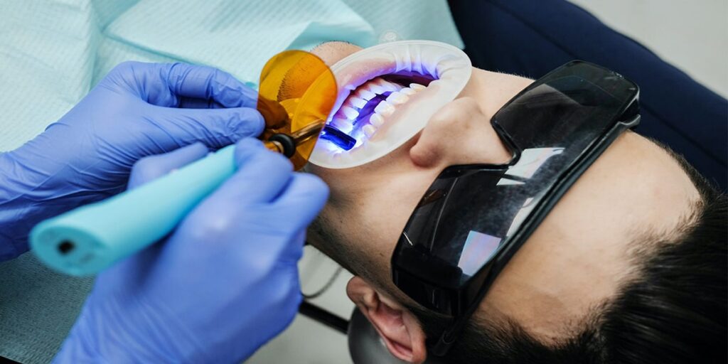 فواید جرم گیری دندان چیست؟